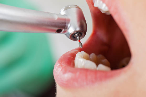 Best Emergency Dental Care for Broken or Chipped Teeth in Dilley, TX